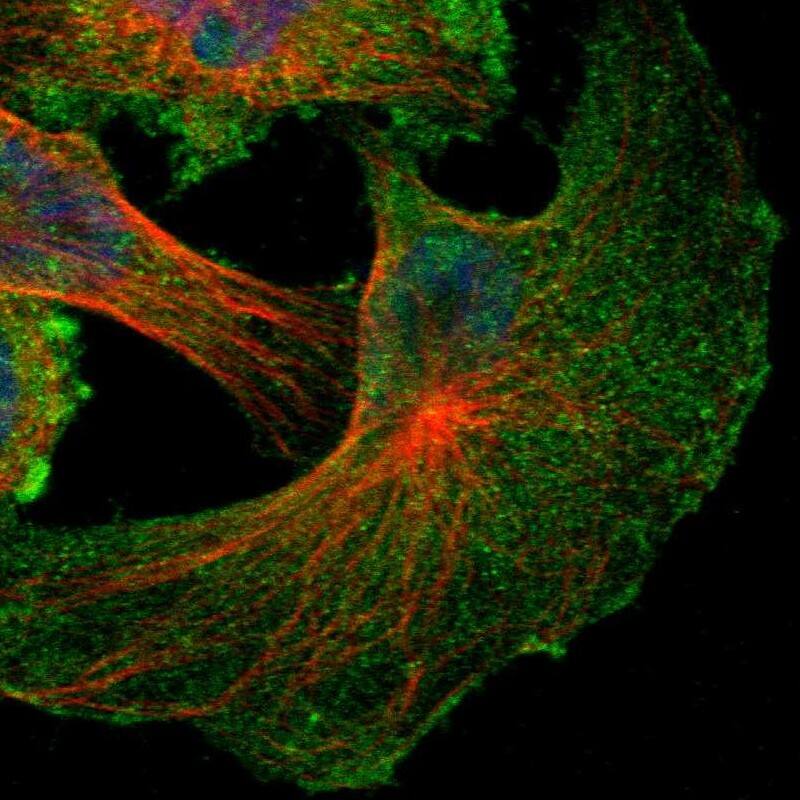 NF2/Merlin Antibody - BSA Free Immunocytochemistry/ Immunofluorescence: NF2/Merlin Antibody [NBP1-87757]