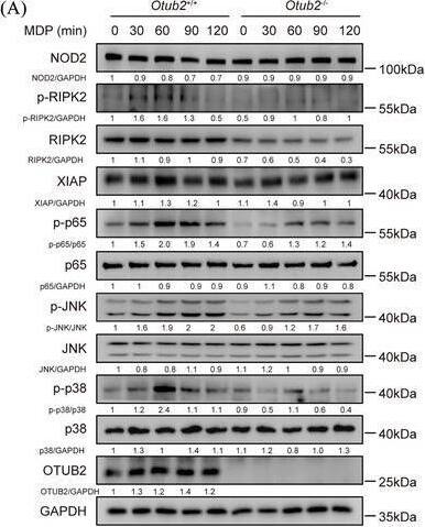Otubain-2 Antibody (OTI11B3)