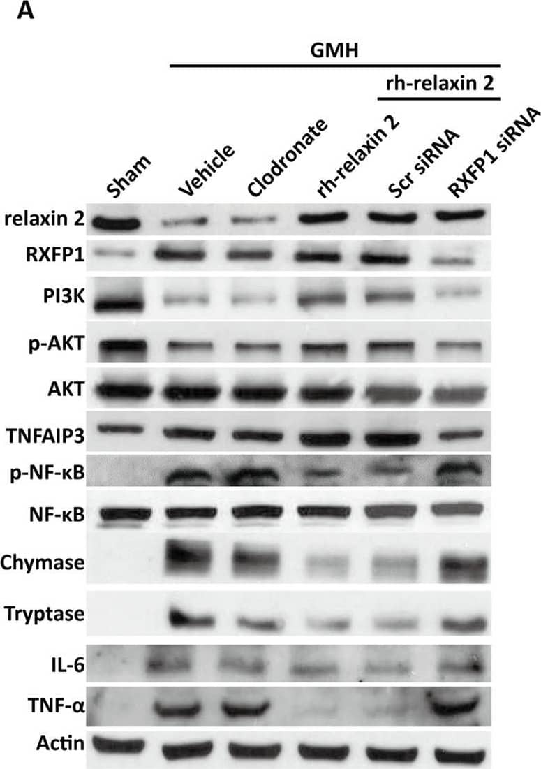 NFkB2/NFkB p100 Antibody - BSA Free