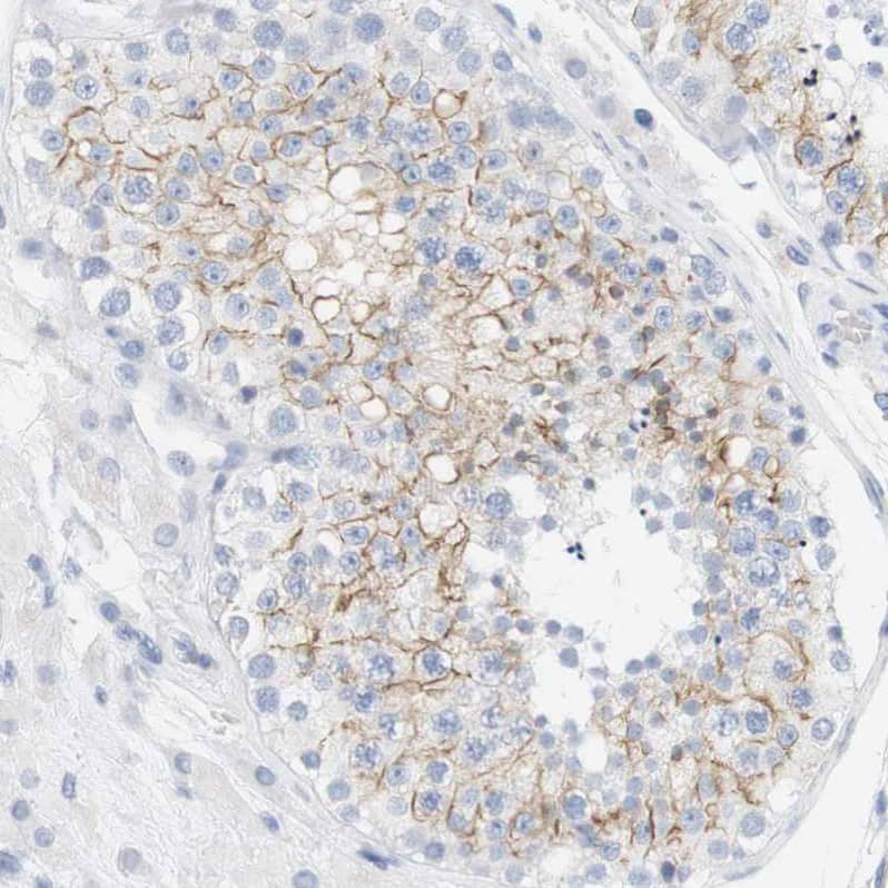 mu Opioid R/OPRM1 Antibody Immunohistochemistry-Paraffin: mu Opioid R/OPRM1 Antibody [NBP1-87767]