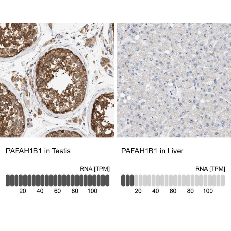 LIS1 Antibody - BSA Free Immunohistochemistry-Paraffin: LIS1 Antibody [NBP1-87769]