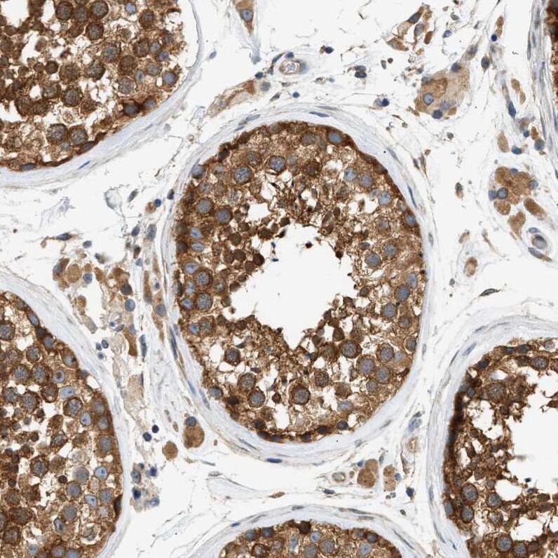 LIS1 Antibody - BSA Free Immunohistochemistry-Paraffin: LIS1 Antibody [NBP1-87769]