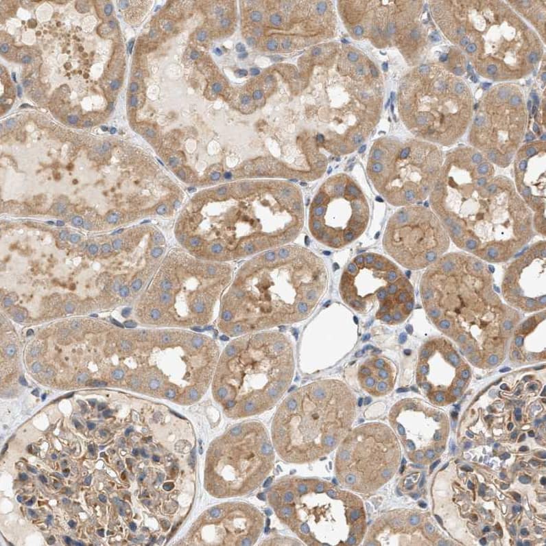 LIS1 Antibody - BSA Free Immunohistochemistry-Paraffin: LIS1 Antibody [NBP1-87769]