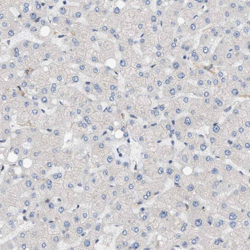 LIS1 Antibody - BSA Free Immunohistochemistry-Paraffin: LIS1 Antibody [NBP1-87769]