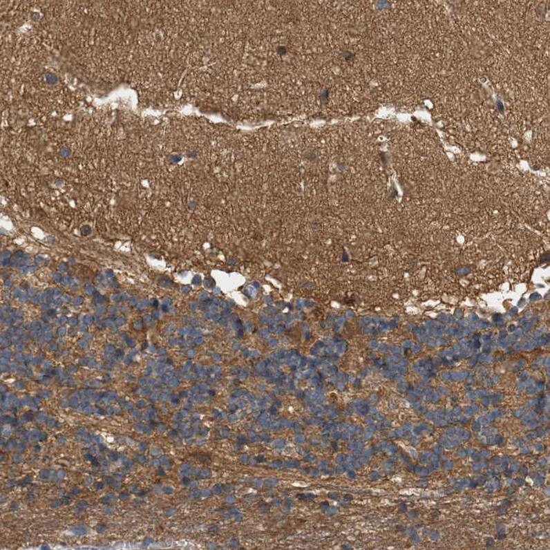 LIS1 Antibody - BSA Free Immunohistochemistry-Paraffin: LIS1 Antibody [NBP1-87769]