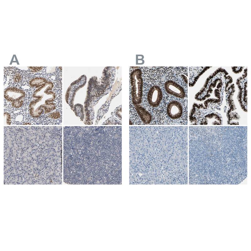 Progesterone R/NR3C3 Antibody Immunohistochemistry-Paraffin: Progesterone R/NR3C3 Antibody Antibody [NBP1-87774]