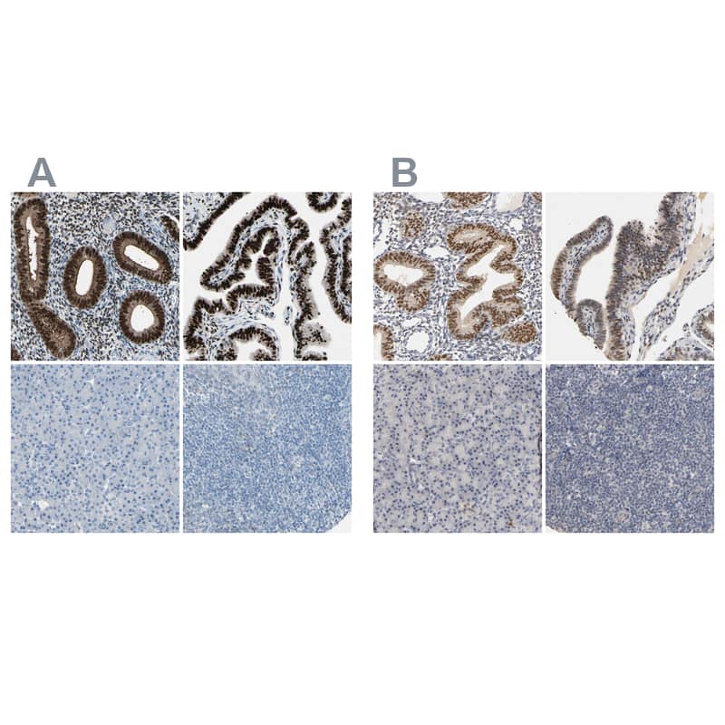 Progesterone R/NR3C3 Antibody Immunohistochemistry-Paraffin: Progesterone R/NR3C3 Antibody Antibody [NBP1-87776]