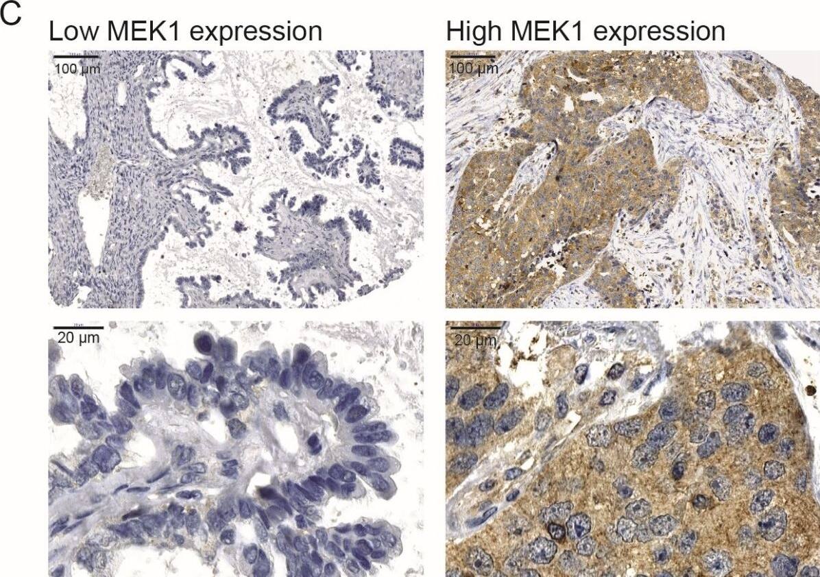 MEK1 Antibody
