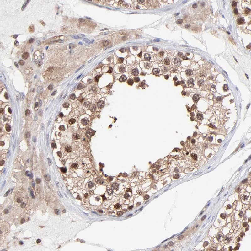 Proteasome 20S alpha 6 Antibody - BSA Free Immunohistochemistry-Paraffin: Proteasome 20S alpha 6 Antibody [NBP1-87796]