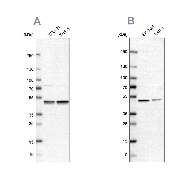 Proteasome 19S S7 Antibody Western Blot: Proteasome 19S S7 Antibody Antibody [NBP1-87797]
