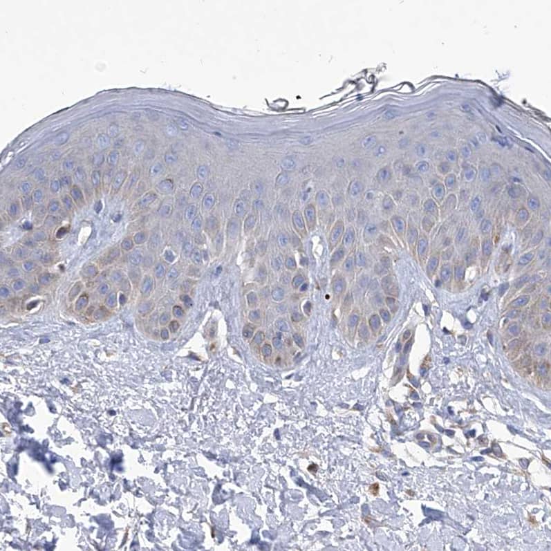 Spermine synthase Antibody - BSA Free Immunohistochemistry-Paraffin: Spermine synthase Antibody [NBP1-87812]