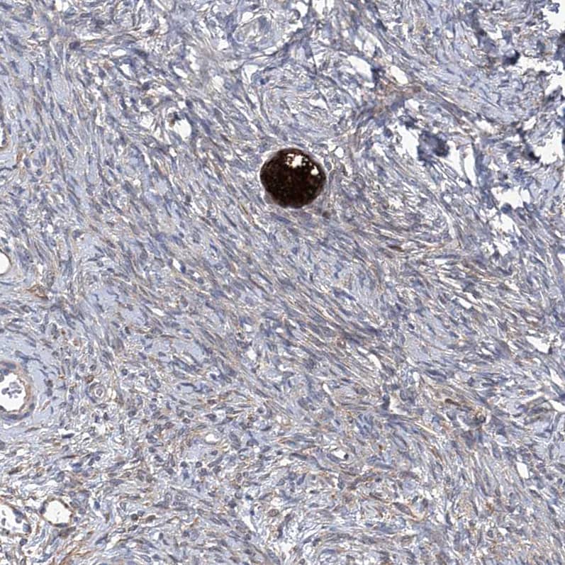 Spermine synthase Antibody - BSA Free Immunohistochemistry-Paraffin: Spermine synthase Antibody [NBP1-87812]