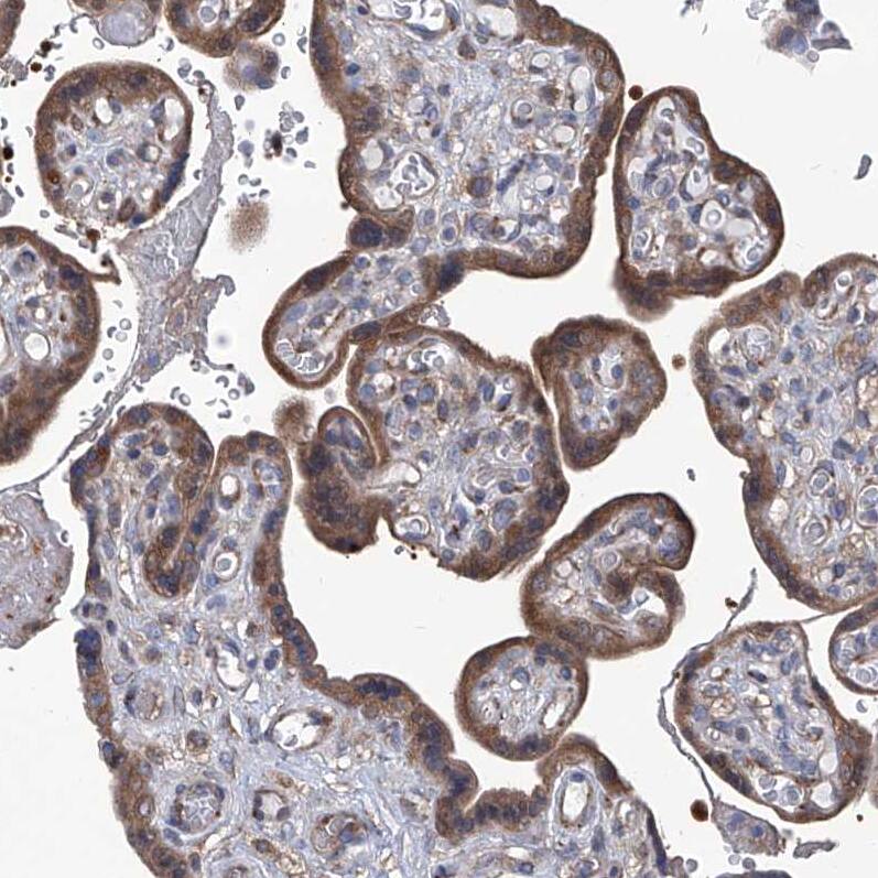 Spermine synthase Antibody - BSA Free Immunohistochemistry-Paraffin: Spermine synthase Antibody [NBP1-87812]