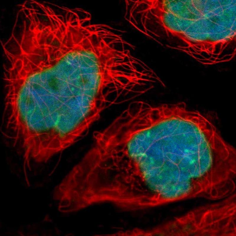 Thymopoietin/LAP2 Antibody - BSA Free Immunocytochemistry/ Immunofluorescence: Thymopoietin/LAP2 Antibody [NBP1-87822]