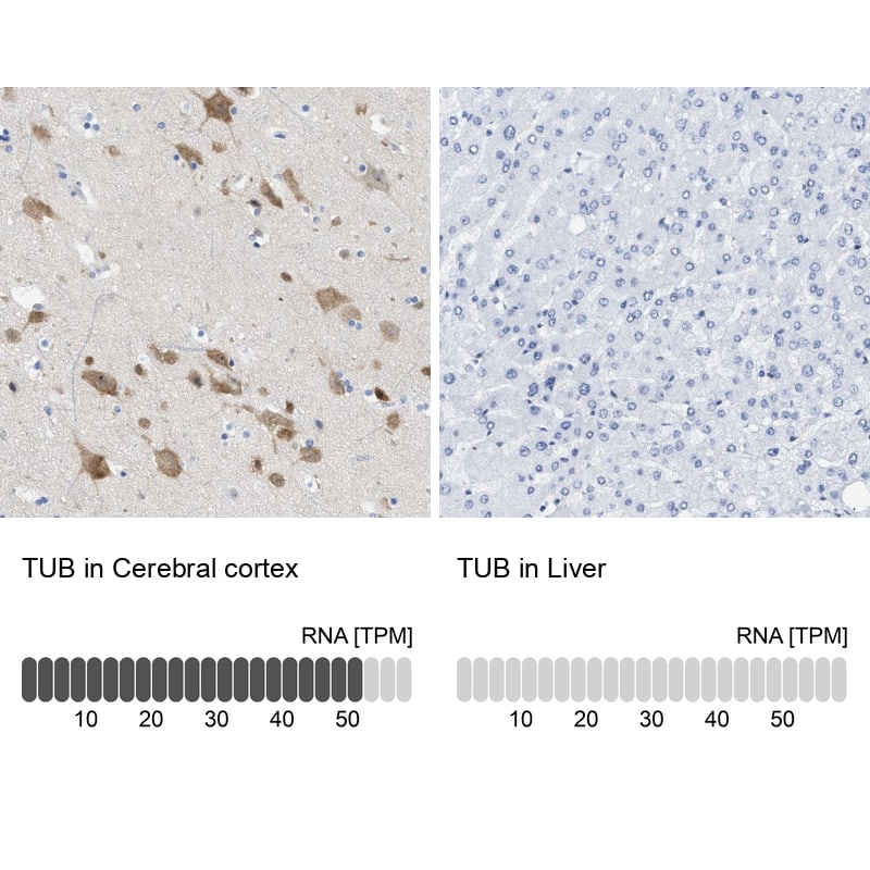 Tubby Antibody - BSA Free Immunohistochemistry-Paraffin: Tubby Antibody [NBP1-87824]