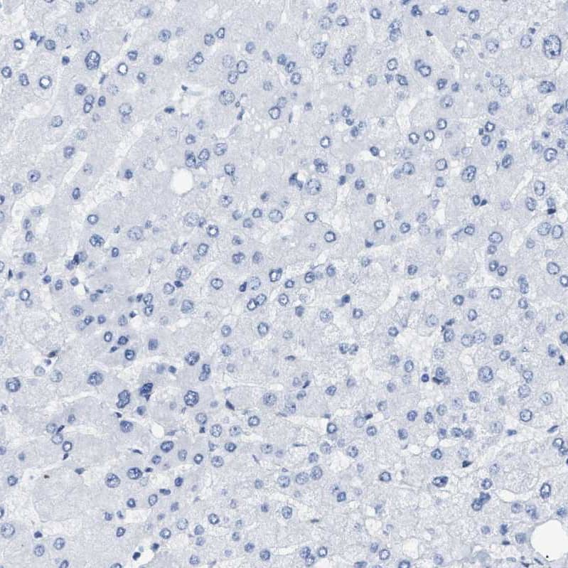 Tubby Antibody - BSA Free Immunohistochemistry-Paraffin: Tubby Antibody [NBP1-87824]