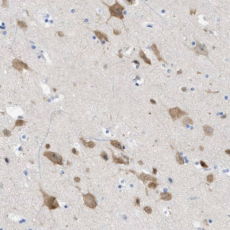 Tubby Antibody - BSA Free Immunohistochemistry-Paraffin: Tubby Antibody [NBP1-87824]