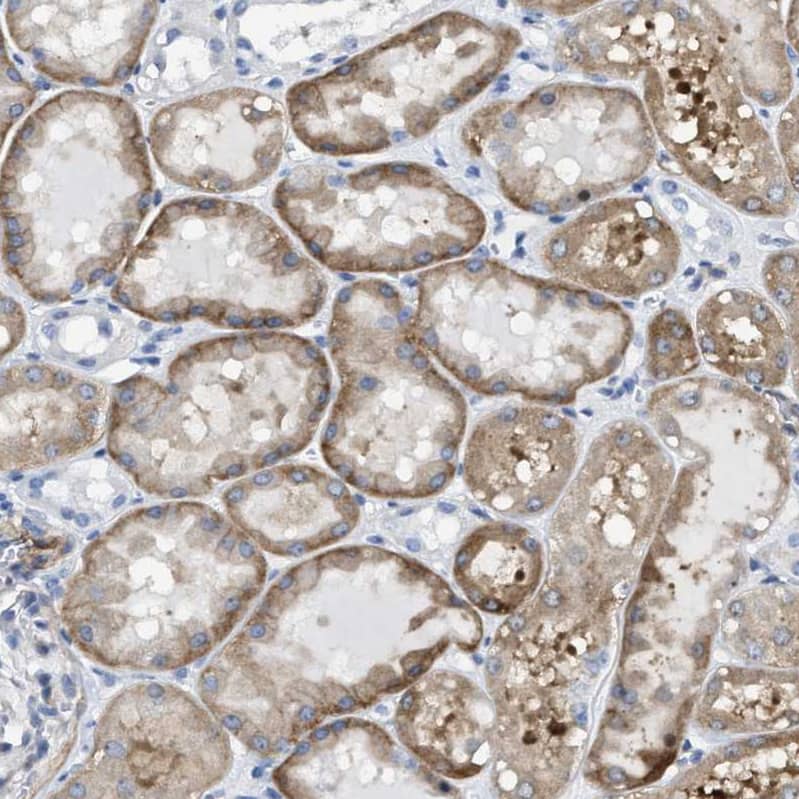 Tubby Antibody - BSA Free Immunohistochemistry-Paraffin: Tubby Antibody [NBP1-87824]