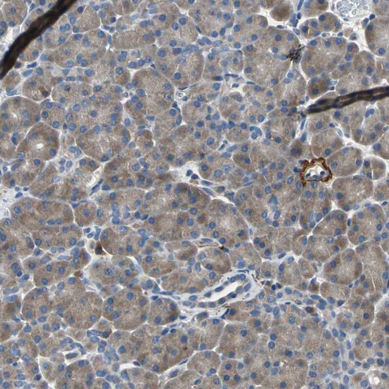 MCT2 Antibody - BSA Free Immunohistochemistry-Paraffin: MCT2 Antibody - BSA Free [NBP1-87846]
