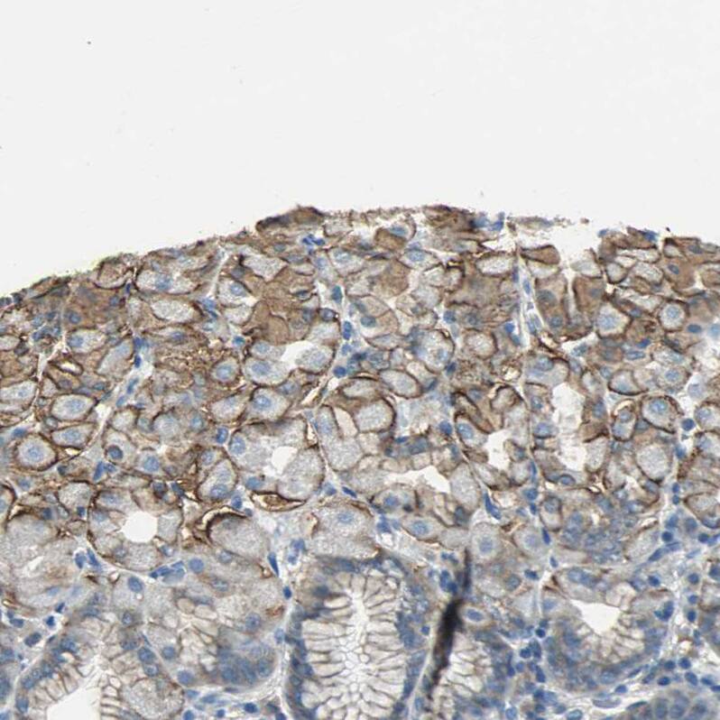 MCT2 Antibody - BSA Free Immunohistochemistry-Paraffin: MCT2 Antibody - BSA Free [NBP1-87846]