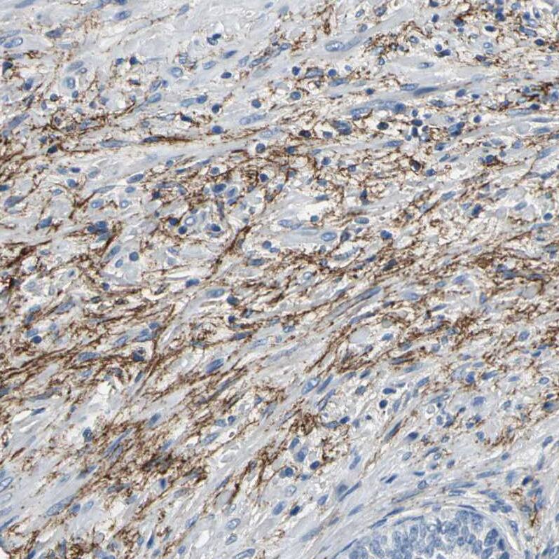 MCT2 Antibody - BSA Free Immunohistochemistry-Paraffin: MCT2 Antibody - BSA Free [NBP1-87846]