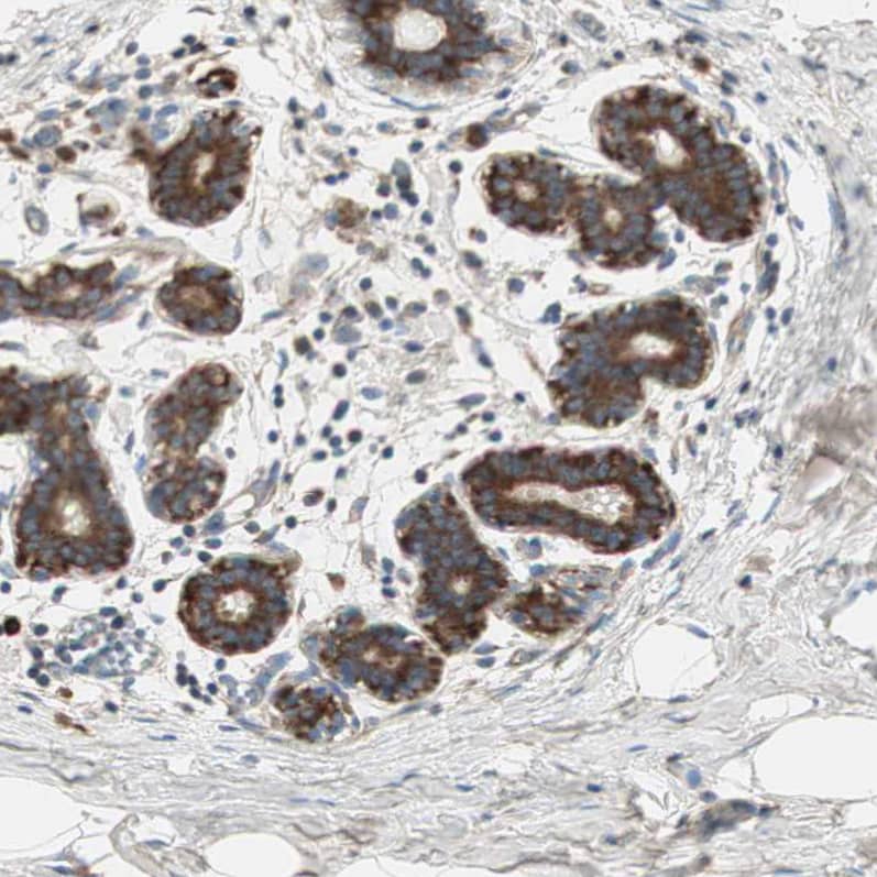 60S ribosomal protein L23 Antibody - BSA Free Immunohistochemistry-Paraffin: 60S ribosomal protein L23 Antibody - BSA Free [NBP1-87847]
