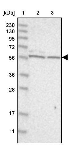 ICB1 Antibody - BSA Free Western Blot: ICB1 Antibody - BSA Free [NBP1-87849]