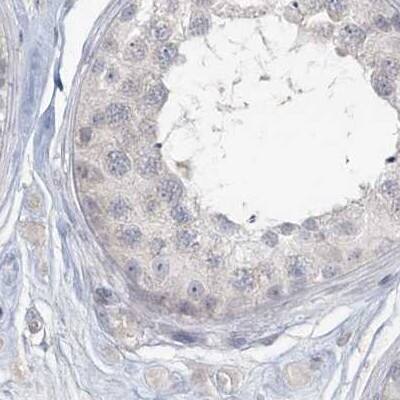 Myotilin Antibody - BSA Free Immunohistochemistry-Paraffin: Myotilin Antibody [NBP1-87851]