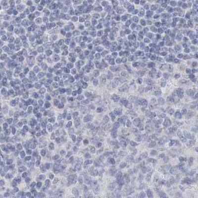 Myotilin Antibody - BSA Free Immunohistochemistry-Paraffin: Myotilin Antibody [NBP1-87851]