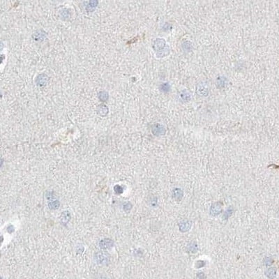 Myotilin Antibody - BSA Free Immunohistochemistry-Paraffin: Myotilin Antibody [NBP1-87851]
