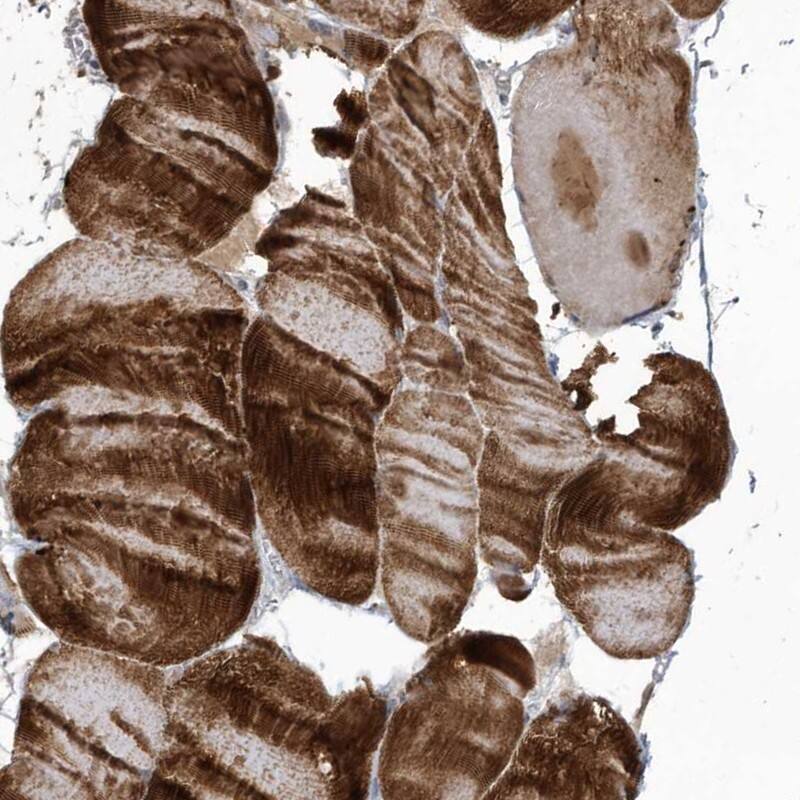 Myotilin Antibody - BSA Free Immunohistochemistry-Paraffin: Myotilin Antibody - BSA Free [NBP1-87851]