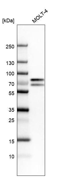 TOX Antibody - BSA Free Western Blot: TOX Antibody - BSA Free [NBP1-87857]