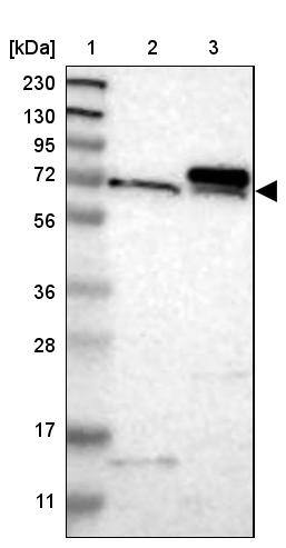 TOM70 Antibody - BSA Free Western Blot: TOM70 Antibody - BSA Free [NBP1-87863]