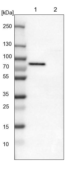 TOM70 Antibody - BSA Free Western Blot: TOM70 Antibody - BSA Free [NBP1-87863]