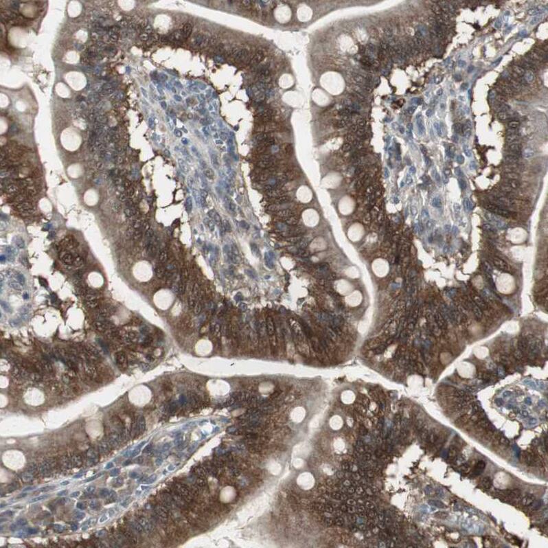 Perilipin-3/TIP47 Antibody - BSA Free Immunohistochemistry-Paraffin: Perilipin-3/TIP47 Antibody [NBP1-87871]