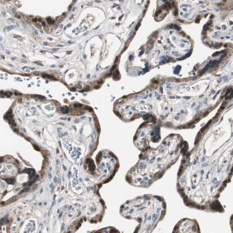 Perilipin-3/TIP47 Antibody - BSA Free Immunohistochemistry-Paraffin: Perilipin-3/TIP47 Antibody [NBP1-87871]