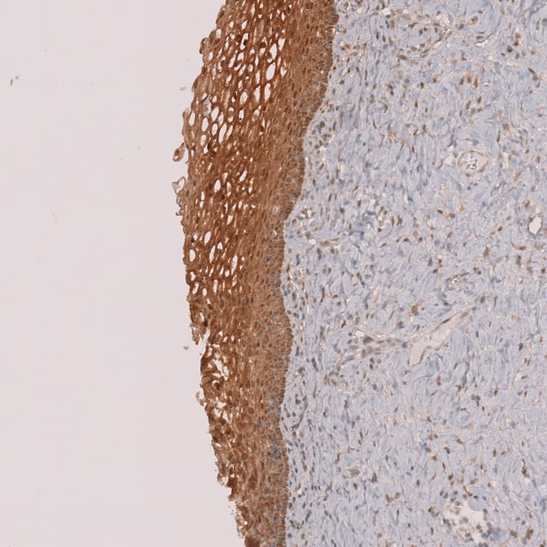 Perilipin-3/TIP47 Antibody - BSA Free Immunohistochemistry-Paraffin: Perilipin-3/TIP47 Antibody [NBP1-87871]