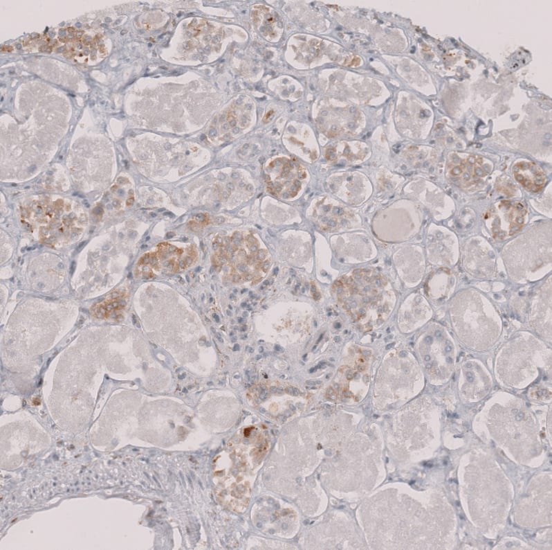Perilipin-3/TIP47 Antibody - BSA Free Immunohistochemistry-Paraffin: Perilipin-3/TIP47 Antibody [NBP1-87871]