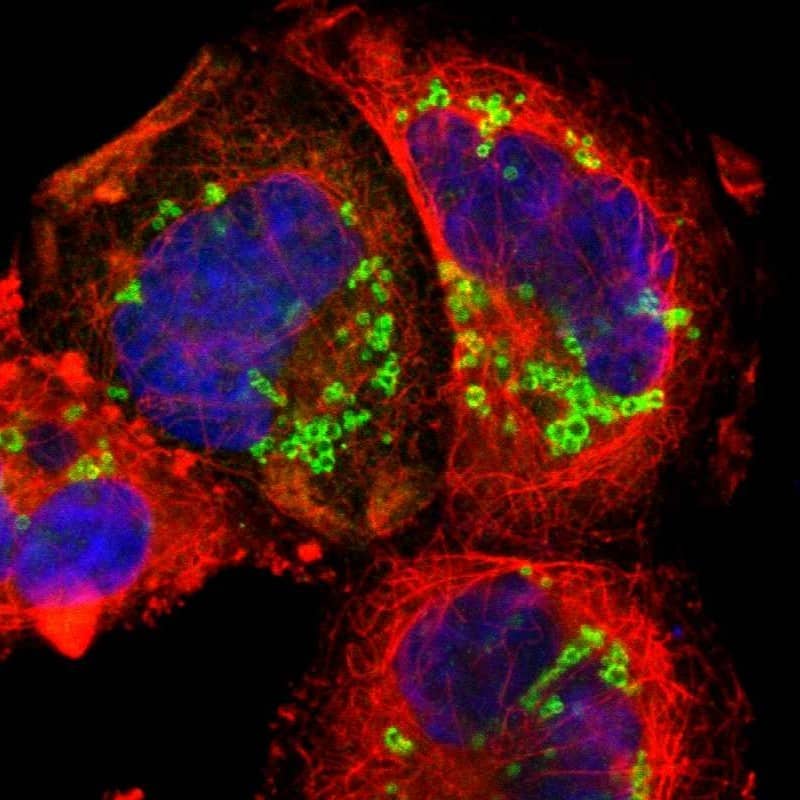 Perilipin-3/TIP47 Antibody - BSA Free Immunocytochemistry/ Immunofluorescence: Perilipin-3/TIP47 Antibody - BSA Free [NBP1-87871]