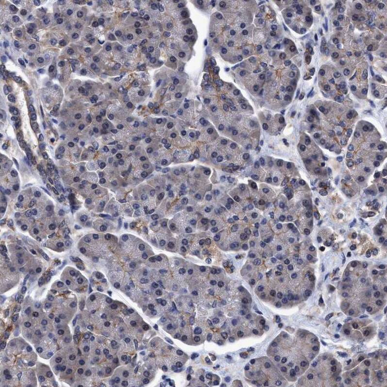 NDP52 Antibody - BSA Free Immunohistochemistry-Paraffin: NDP52 Antibody - BSA Free [NBP1-87872]
