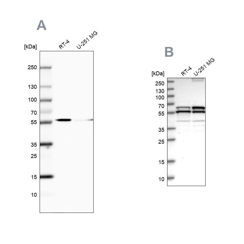 NDP52 Antibody - BSA Free Western Blot: NDP52 Antibody - BSA Free [NBP1-87872]