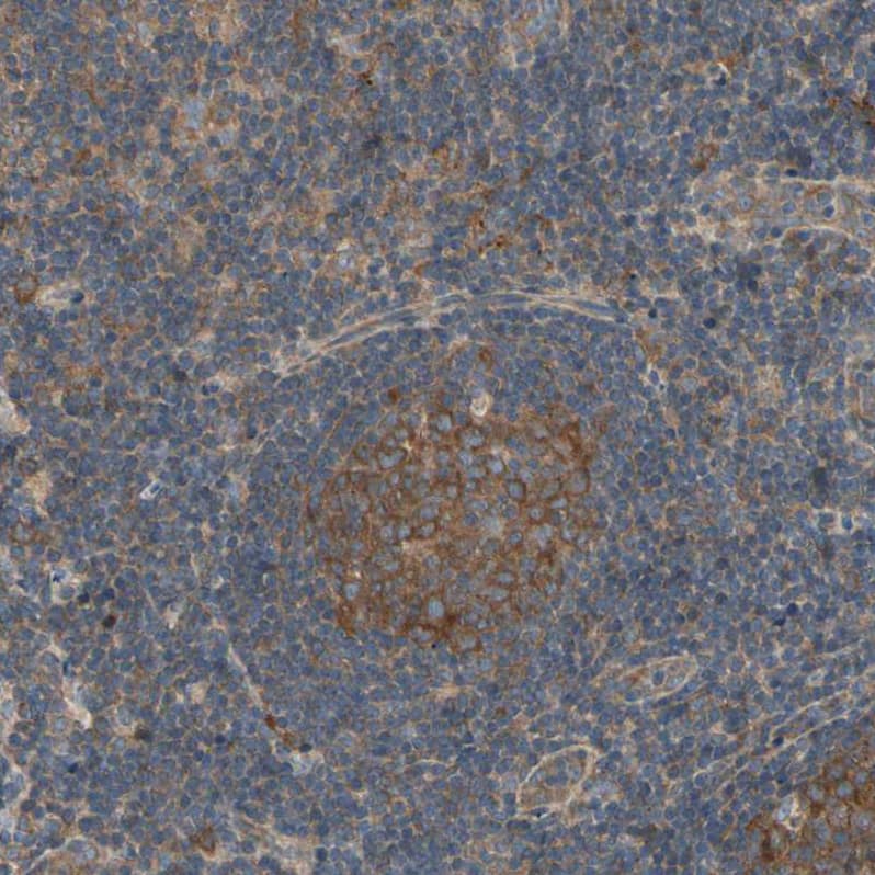 IRAG Antibody - BSA Free Immunohistochemistry-Paraffin: IRAG Antibody - BSA Free [NBP1-87877]