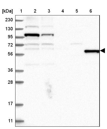 MSL3L1 Antibody - BSA Free Western Blot: MSL3L1 Antibody - BSA Free [NBP1-87881]