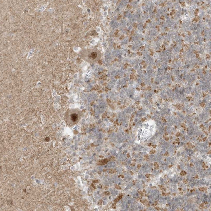 MSL3L1 Antibody - BSA Free Immunohistochemistry-Paraffin: MSL3L1 Antibody [NBP1-87882]