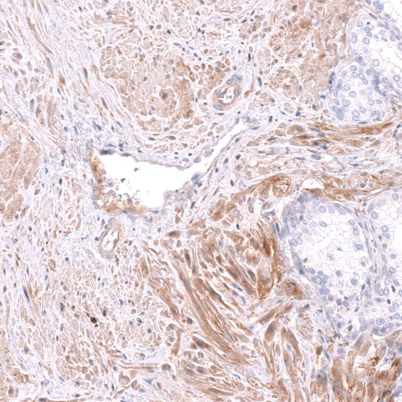 MIG2/Kindlin-2 Antibody - BSA Free Immunohistochemistry-Paraffin: MIG2/Kindlin-2 Antibody - BSA Free [NBP1-87884]