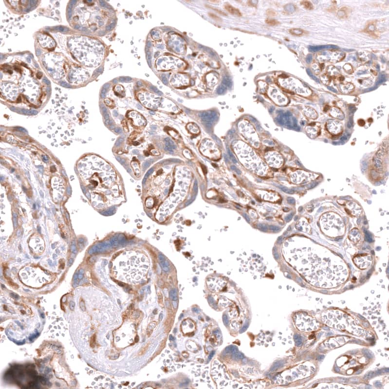 MIG2/Kindlin-2 Antibody - BSA Free Immunohistochemistry-Paraffin: MIG2/Kindlin-2 Antibody - BSA Free [NBP1-87884]