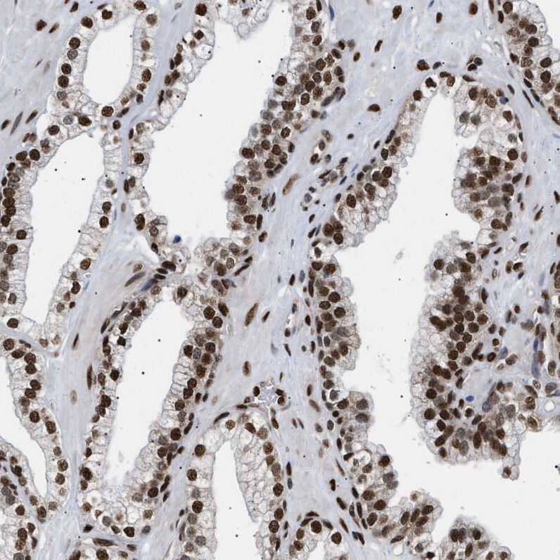 LEDGF Antibody - BSA Free Immunohistochemistry-Paraffin: LEDGF Antibody - BSA Free [NBP1-87885]