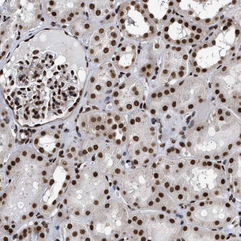 LEDGF Antibody - BSA Free Immunohistochemistry-Paraffin: LEDGF Antibody - BSA Free [NBP1-87885]