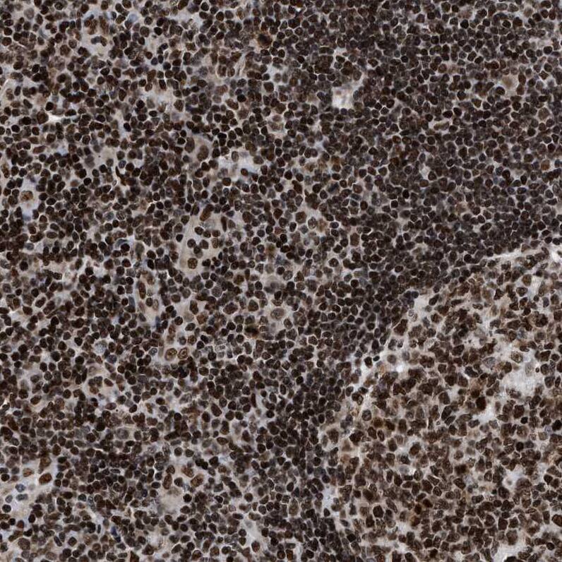 LEDGF Antibody - BSA Free Immunohistochemistry-Paraffin: LEDGF Antibody - BSA Free [NBP1-87885]