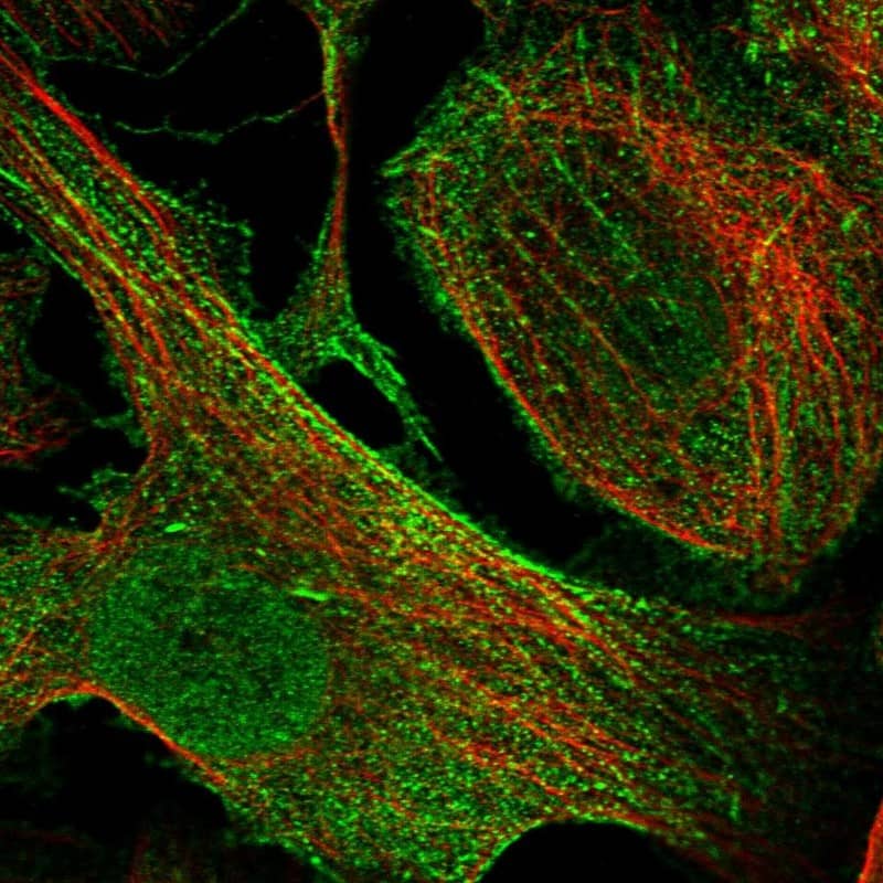 Synaptopodin Antibody - BSA Free Immunocytochemistry/ Immunofluorescence: Synaptopodin Antibody [NBP1-87887]